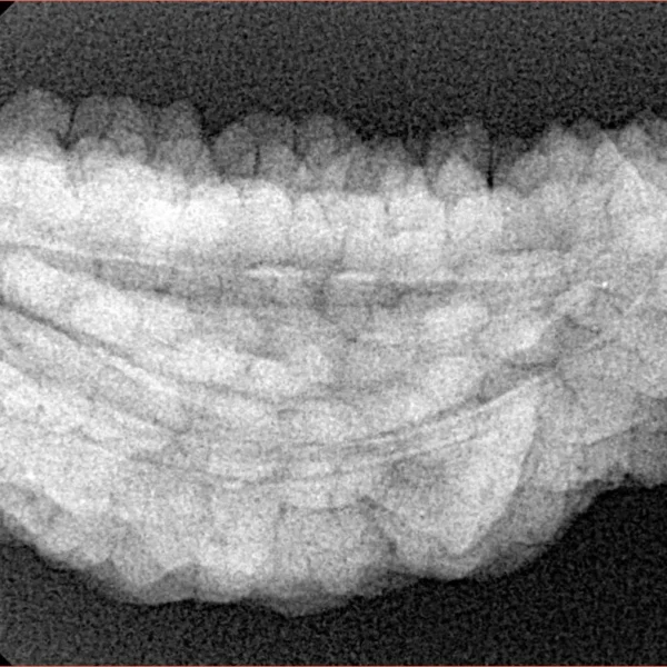 1 Mukhi Rudraksha 37.5mm 5.92gm - Xray