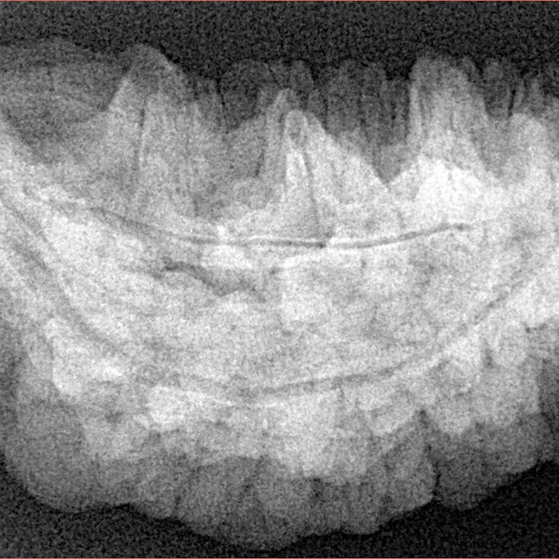 1 Mukhi Rudraksha 33.9mm 5.83gm - Xray