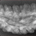 1 Mukhi Rudraksha 38.6mm 3.02gm - Xray