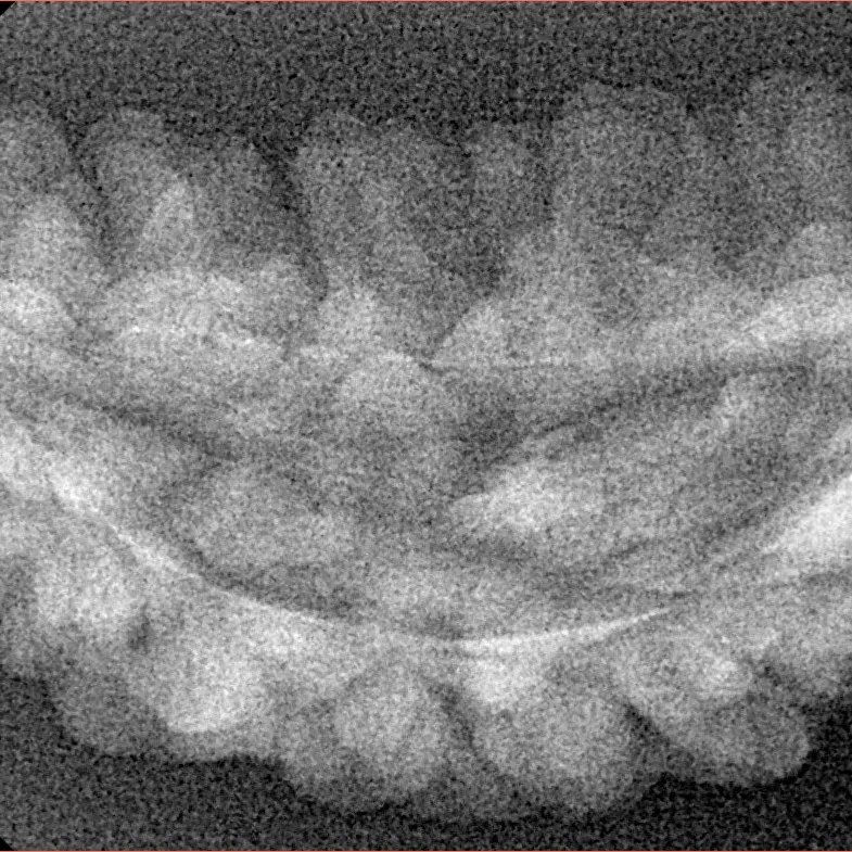 1 Mukhi Rudraksha 38.6mm 3.02gm - Xray