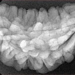1 Mukhi Rudraksha 35.7mm 5.17gm - Xray
