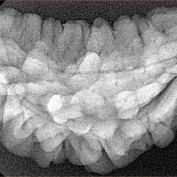 1 Mukhi Rudraksha 35.7mm 5.17gm - Xray