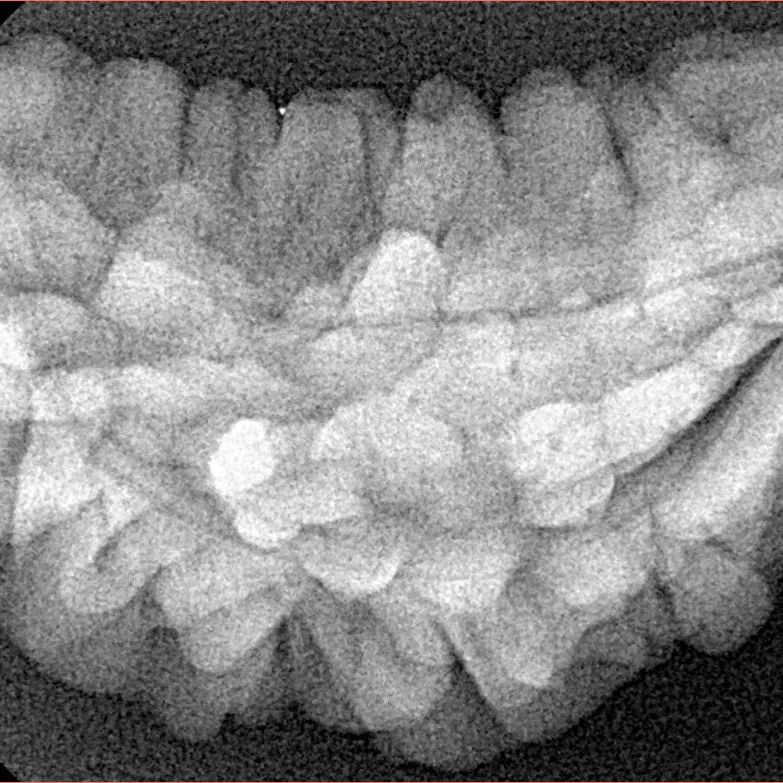 1 Mukhi Rudraksha 35.7mm 5.17gm - Xray