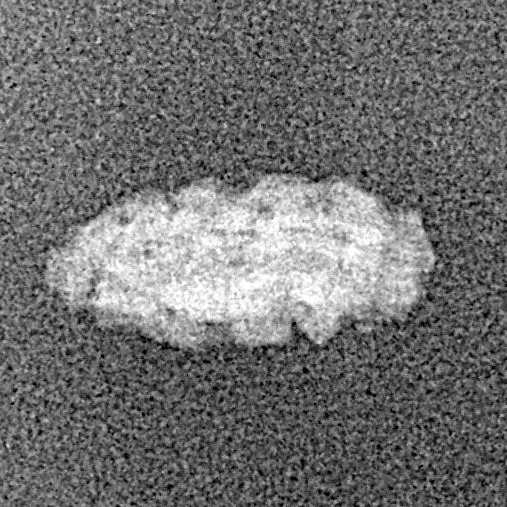 1 Mukhi Rudraksha 12.9mm 0.21gm - Xray