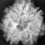 7 Mukhi Rudraksha 27mm 7.63gm - Xray