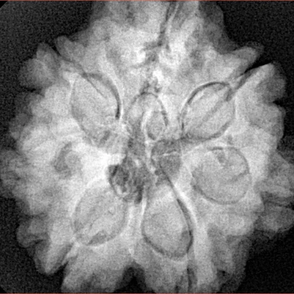 7 Mukhi Rudraksha 27mm 7.63gm - Xray