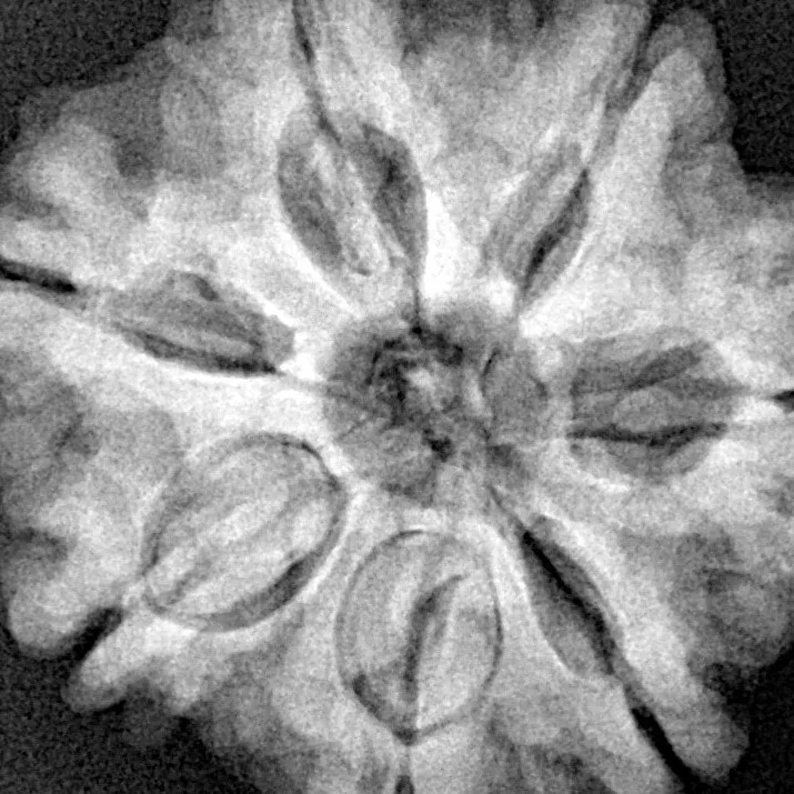 7 Mukhi Rudraksha 27.1mm 6.85gm - Xray