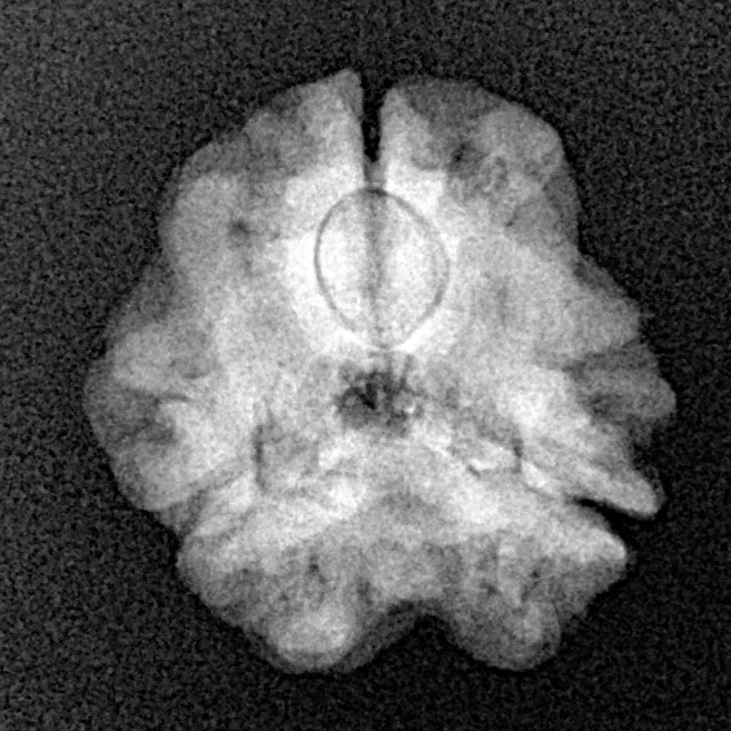 3 Mukhi Rudraksha 18.4mm 2.32gm - Xray