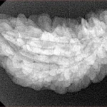 1 Mukhi Rudraksha 34.1mm 4.47gm - Xray