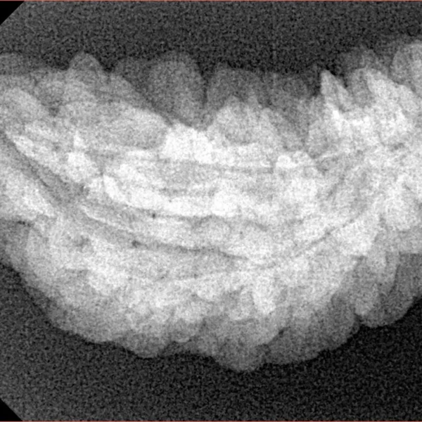 1 Mukhi Rudraksha 34.1mm 4.47gm - Xray