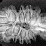 16 Mukhi Trijuti 37.6mm 6.33gm - Xray