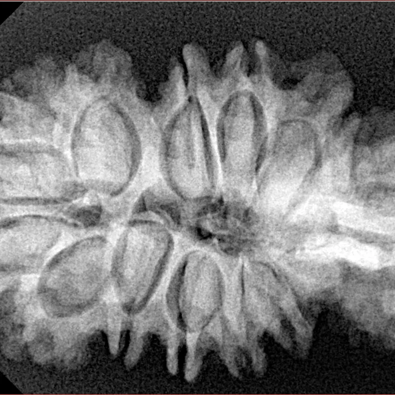 16 Mukhi Trijuti 37.6mm 6.33gm - Xray