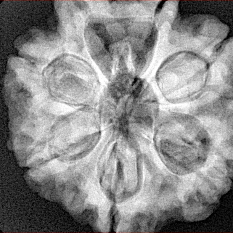 7 Mukhi Rudraksha 28.3mm 7.68gm - Xray