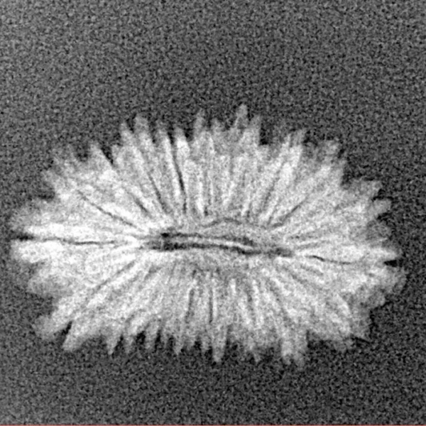 19 Mukhi Rudraksha 21.3mm 1.16gm - Xray