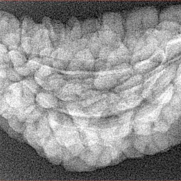 1 Mukhi Rudraksha 36.5mm 4.55gm - Xray