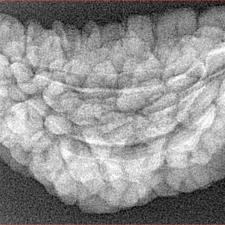 1 Mukhi Rudraksha 36.5mm 4.55gm - Xray