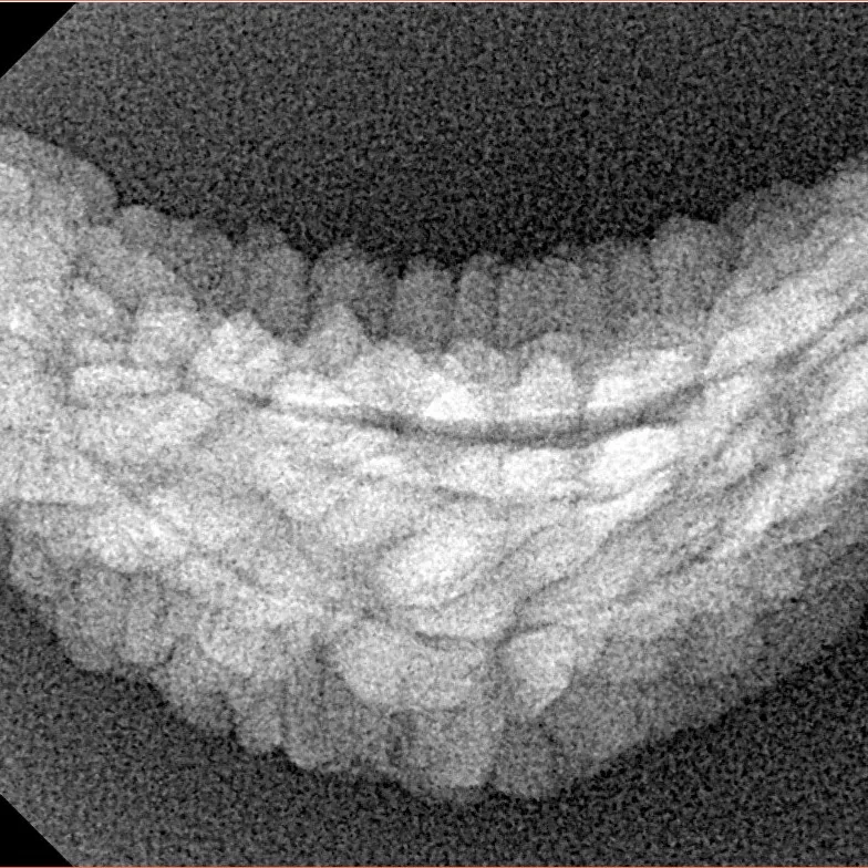 1 Mukhi Rudraksha 31.4mm 2.64gm - Xray