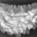 1 Mukhi Rudraksha 36.3mm 5gm - Xray
