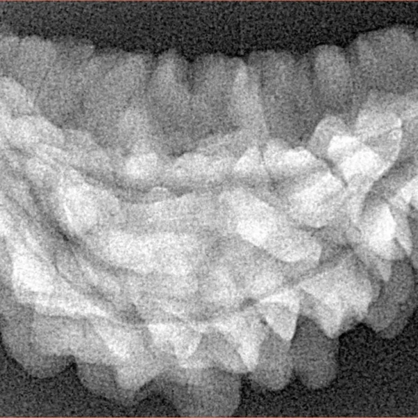 1 Mukhi Rudraksha 36.3mm 5gm - Xray