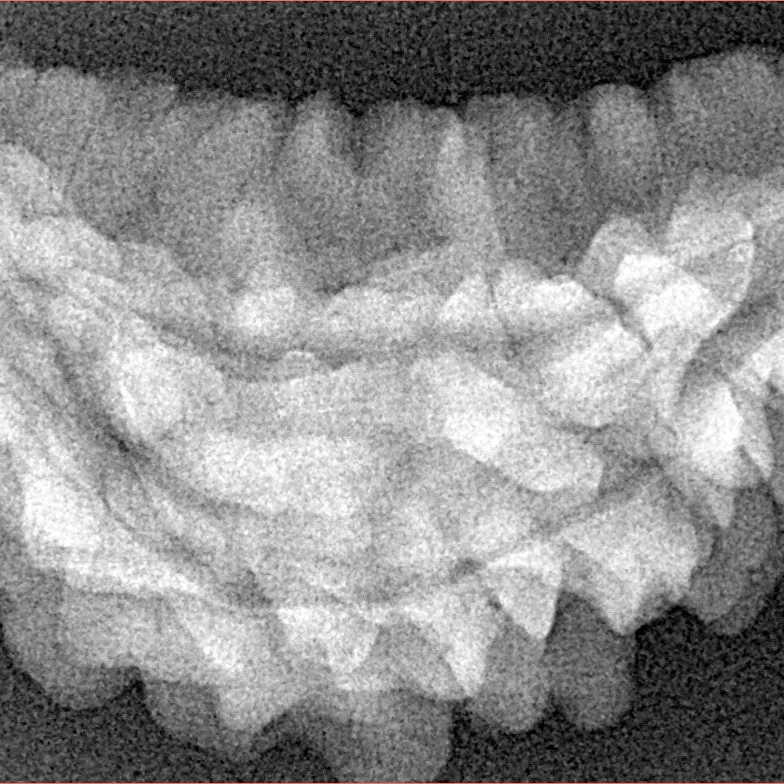 1 Mukhi Rudraksha 36.3mm 5gm - Xray