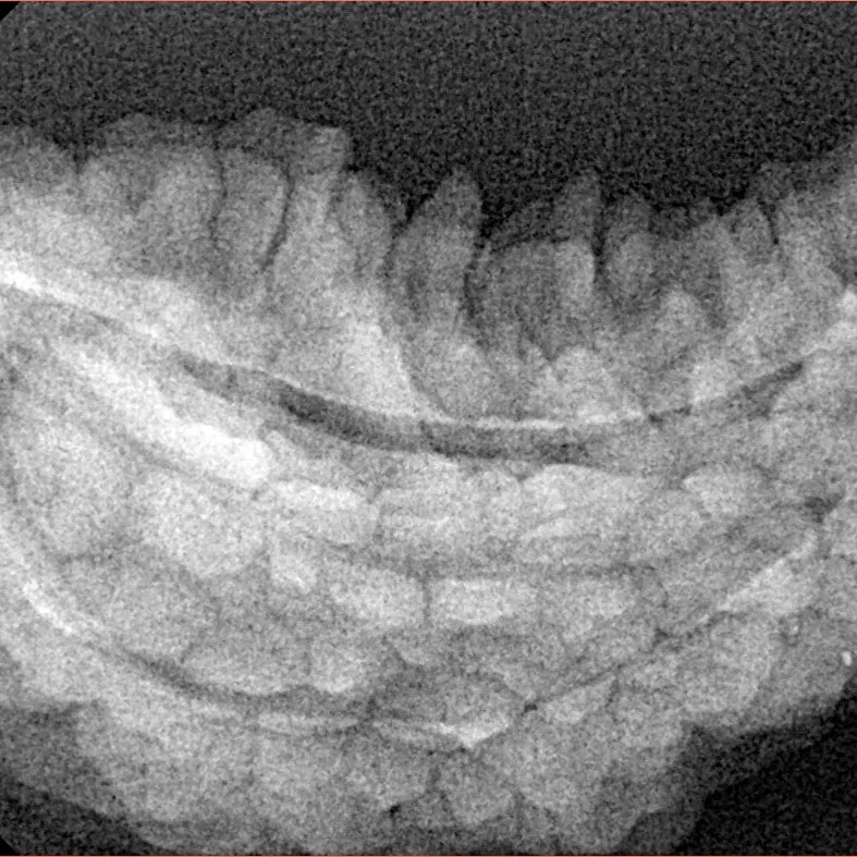 1 Mukhi Rudraksha 37.5mm 5.73gm - Xray