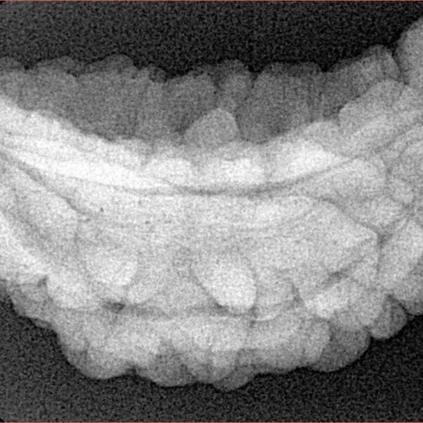 1 Mukhi Rudraksha 37.3mm 5.59gm - Xray