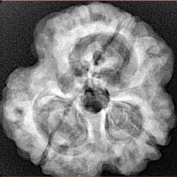 3 Mukhi Rudraksha 28.8mm 6.68gm - Xray