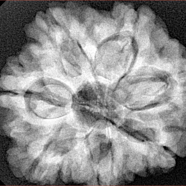 7 Mukhi Rudraksha 28.4mm 7.24gm - Xray