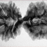 11 Mukhi Rudraksha 37.6mm 7gm - Inverse xray