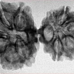 11 MK Gaurishankar 36.1mm 4.82gm - Inverse xray