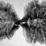 11 MK Gaurishankar 41.9mm 8.05gm - Inverse xray