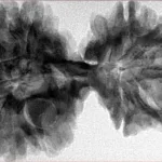 10 Mk Gaurishankar 40.1mm 8.13gm - Inverse xray