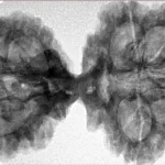 10 Mk Gaurishankar 42.4mm 8.24gm - Inverse xray