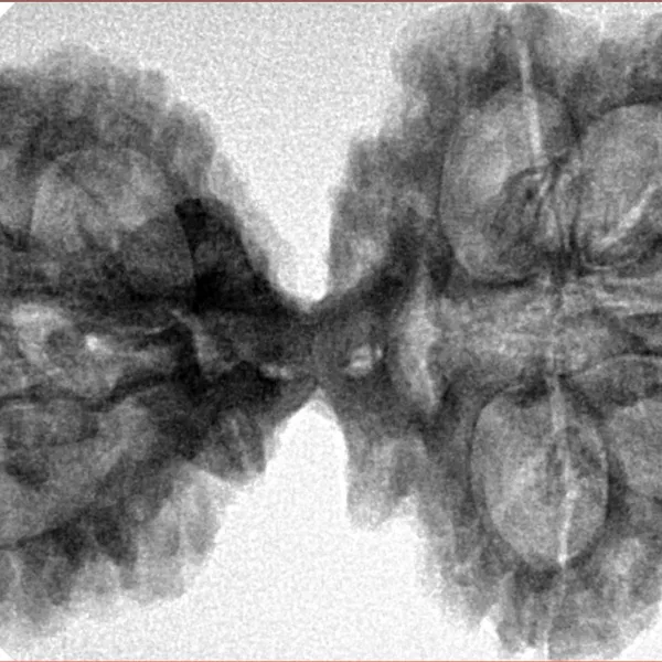10 Mk Gaurishankar 42.4mm 8.24gm - Inverse xray