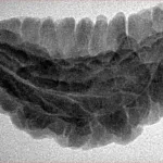 1 Mukhi Rudraksha 33.7mm 4.86gm - Inverse xray