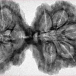 9 MK Gaurishankar 39.3mm 7.49gm - Inverse xray