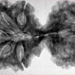 10 Mk Gaurishankar 40.2mm 6.87gm - Inverse xray