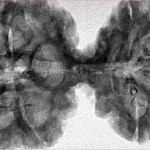 9 MK Gaurishankar 45.6mm 9.62gm - Inverse xray