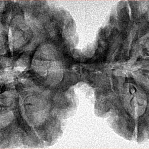 9 MK Gaurishankar 45.6mm 9.62gm - Inverse xray