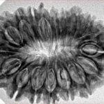 18 Mukhi Rudraksha 31.9mm 5.28gm - Inverse xray
