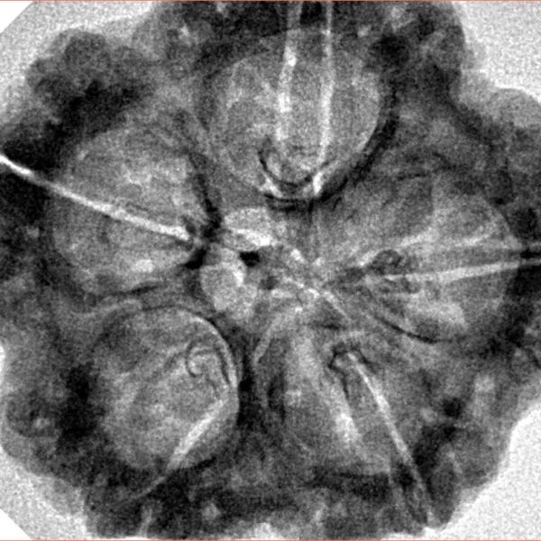5 Mukhi Rudraksha 30.2mm 6.63gm - Inverse xray