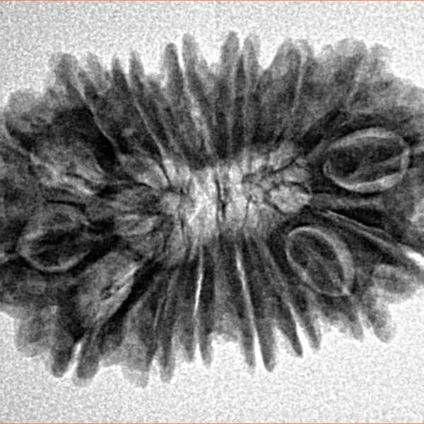 16 Mukhi Rudraksha 28mm 3.72gm - Inverse xray