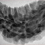1 Mukhi Rudraksha 34.6mm 5gm - Origin: South India - Inverse xray