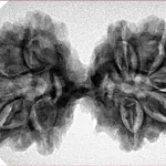 10 Mk Gaurishankar 36.1mm 6.25gm - Inverse xray