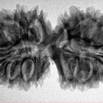 19 MK Gaurishankar 36mm 5.69gm - Inverse xray