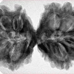9 MK Gaurishankar 37.9mm 7.67gm - Inverse xray