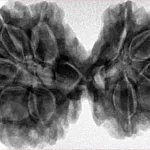 10 Mk Gaurishankar 39.4mm 9.2gm - Inverse xray