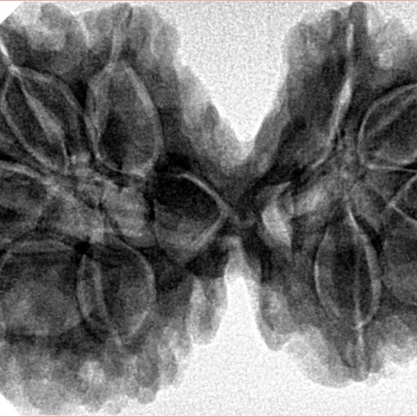 10 Mk Gaurishankar 39.4mm 9.2gm - Inverse xray