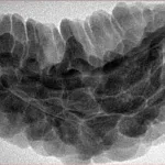1 Mukhi Rudraksha 34.9mm 6.75gm - Inverse xray