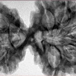 9 MK Gaurishankar 42.6mm 9.73gm - Inverse xray